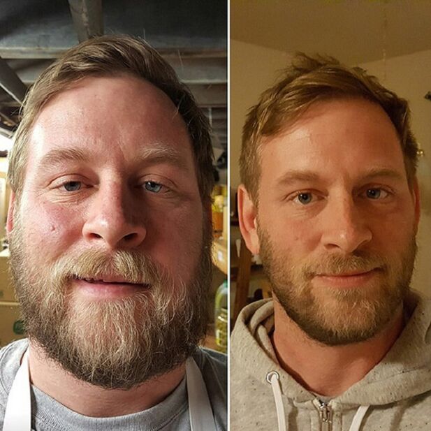 a aparência da pessoa antes e depois de abandonar o álcool